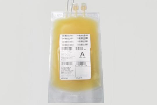 Thrombozytenkonzentrate leukozytendepletiert aus Thrombozytapherese oder gepoolten Buffy Coats, pathogeninaktiviert